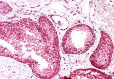 Immunohistochemistry-Paraffin: PICK1 Antibody [NB100-41403]