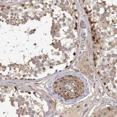 Immunohistochemistry-Paraffin: PICK1 Antibody [NBP2-57605]