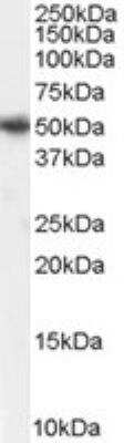 Western Blot: PICK1 Antibody [NB100-41403]