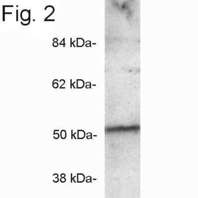 Western Blot: PICK1 Antibody [NB120-3420]