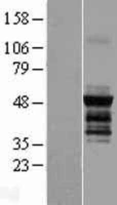 Western Blot: PICK1 Overexpression Lysate [NBP2-08579]