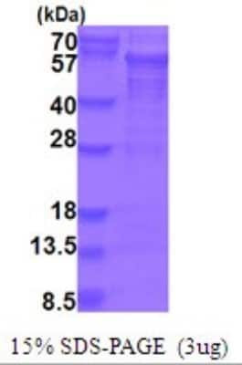 SDS-PAGE: Recombinant Human PICK1 His Protein [NBP2-51934]