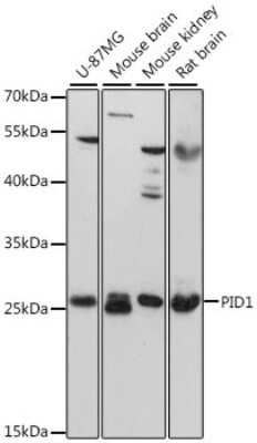 Western Blot: PID1 AntibodyAzide and BSA Free [NBP2-93820]