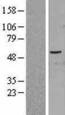 Western Blot: PID1 Overexpression Lysate [NBP2-04366]