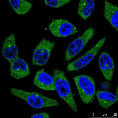 Immunocytochemistry/ Immunofluorescence: PIEZO1 Antibody (2-10) [NBP2-75617]