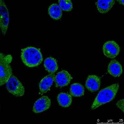 Immunocytochemistry/ Immunofluorescence: PIEZO1 Antibody (2-10) [NBP2-75617]