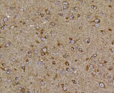 Immunohistochemistry-Paraffin: PIEZO1 Antibody (2-10) [NBP2-75617]