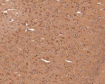 Immunohistochemistry-Paraffin: PIEZO1 Antibody (2-10) [NBP2-75617]