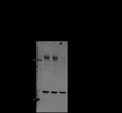 Western Blot: PIEZO1 Antibody (2-10) [NBP2-75617]