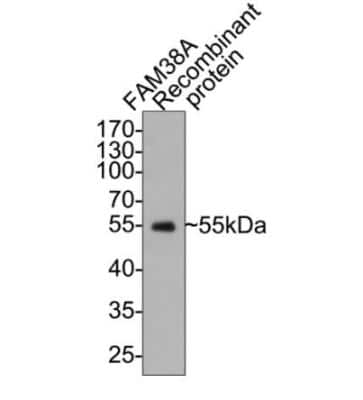 Western Blot: PIEZO1 Antibody (2-10) [NBP2-75617]