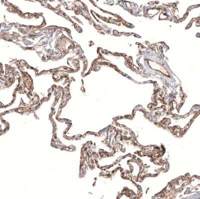 Immunohistochemistry-Paraffin: PIEZO1 Antibody (CL9714) [NBP2-88938]