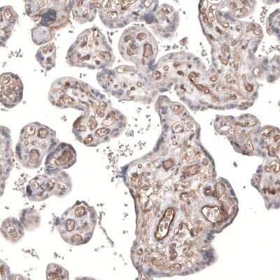 Immunohistochemistry-Paraffin: PIEZO1 Antibody (CL9714) [NBP2-88938]