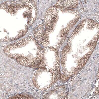 Immunohistochemistry-Paraffin: PIEZO1 Antibody (CL9714) [NBP2-88938]