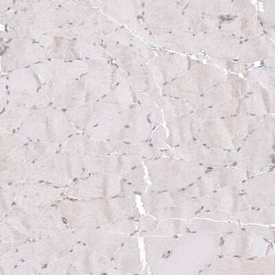 Immunohistochemistry-Paraffin: PIEZO1 Antibody (CL9714) [NBP2-88938]