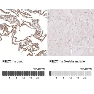 Immunohistochemistry-Paraffin: PIEZO1 Antibody (CL9714) [NBP2-88938]