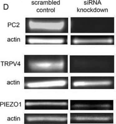 Knockdown Validated: PIEZO1 Antibody [NBP2-10504]