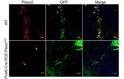 Immunofluorescent Staining of PIEZO2 in Mouse Neurons