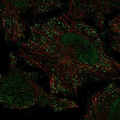 Immunocytochemistry/ Immunofluorescence: PIEZO2 Antibody [NBP2-58161]