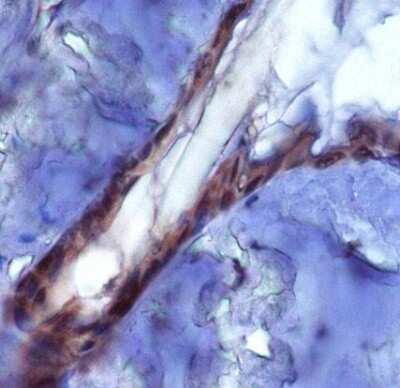 Immunohistochemical Analysis of PIEZO2 in Mouse Epidermis