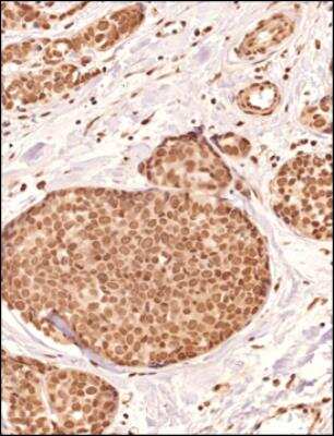 Immunohistochemical Staining of PIEZO2 in Paraffin Embedded Human Breast Tissue
