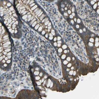 Immunohistochemistry-Paraffin: PIEZO2 Antibody [NBP1-89893]