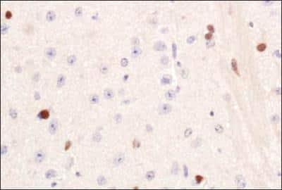 Immunohistochemistry: PIF1 Antibody - BSA Free [NBP1-97931]