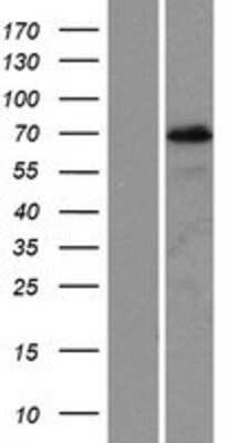 Western Blot: PIF1 Overexpression Lysate [NBP2-06247]