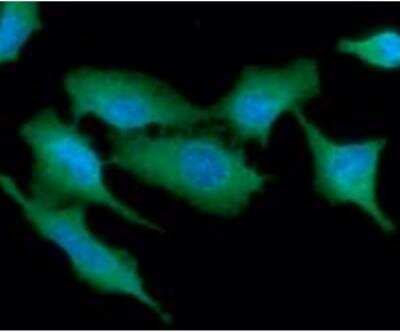 Immunocytochemistry/ Immunofluorescence: PIG3 Antibody (1C9) - BSA Free [NBP2-22591]