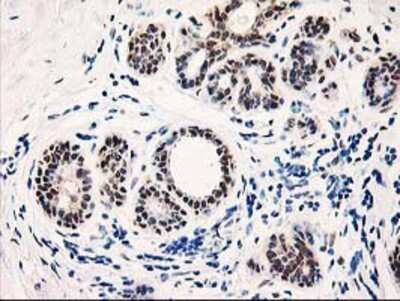 Immunohistochemistry-Paraffin: PIG3 Antibody (OTI3B11) [NBP2-01301]