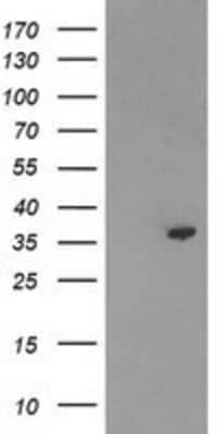 Western Blot: PIG3 Antibody (OTI3B11) [NBP2-01301]