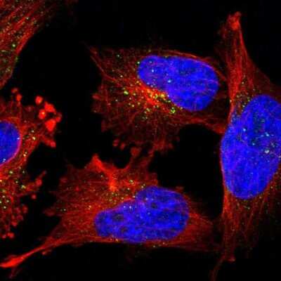 Immunocytochemistry/ Immunofluorescence: PIG3 Antibody [NBP1-87275]