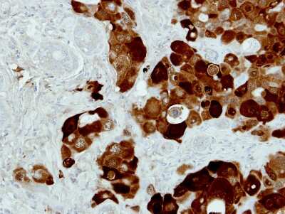 Immunohistochemistry-Paraffin: PIG3 Antibody [NBP1-33237]
