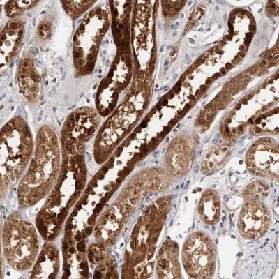 Immunohistochemistry-Paraffin: PIG3 Antibody [NBP1-87274]