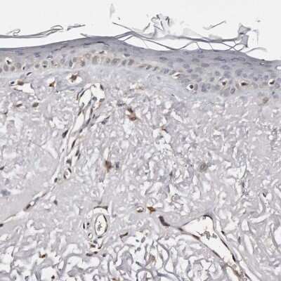Immunohistochemistry-Paraffin: PIG3 Antibody [NBP1-87274]