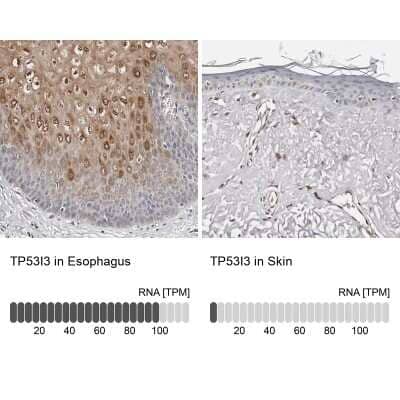 Immunohistochemistry-Paraffin: PIG3 Antibody [NBP1-87274]