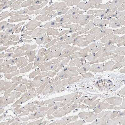 Immunohistochemistry-Paraffin: PIG3 Antibody [NBP1-87275]