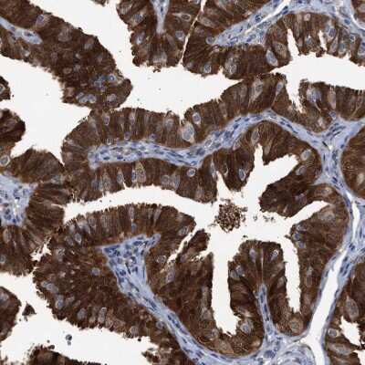 Immunohistochemistry-Paraffin: PIG3 Antibody [NBP1-87275]