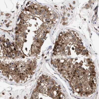Immunohistochemistry-Paraffin: PIG3 Antibody [NBP1-87275]