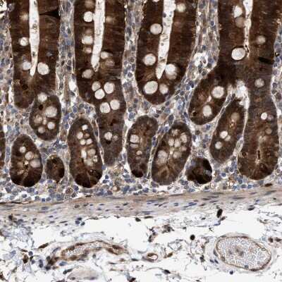 Immunohistochemistry-Paraffin: PIG3 Antibody [NBP1-87275]