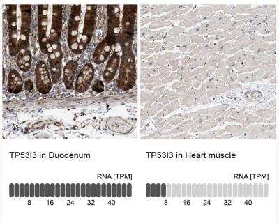 Immunohistochemistry-Paraffin: PIG3 Antibody [NBP1-87275]