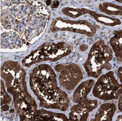 Immunohistochemistry-Paraffin: PIG3 Antibody [NBP1-87275]