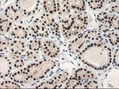 Immunohistochemistry: PIG3 Antibody (OTI3B11) - Azide and BSA Free [NBP2-73400]