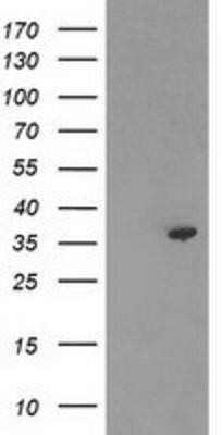 Western Blot: PIG3 Antibody (OTI3B11)Azide and BSA Free [NBP2-73400]