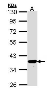 Western Blot: PIG3 Antibody [NBP1-33237]