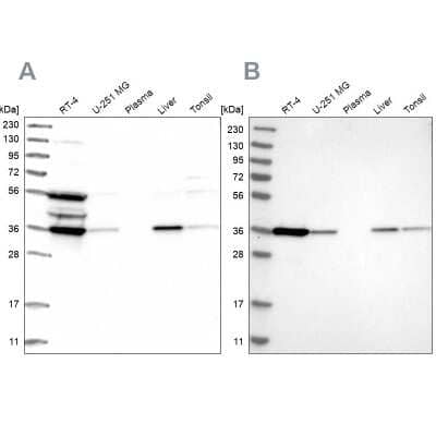 Western Blot: PIG3 Antibody [NBP1-87274]