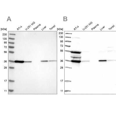 Western Blot: PIG3 Antibody [NBP1-87275]