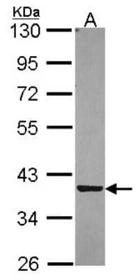 Western Blot: PIG3 Antibody [NBP2-19826]