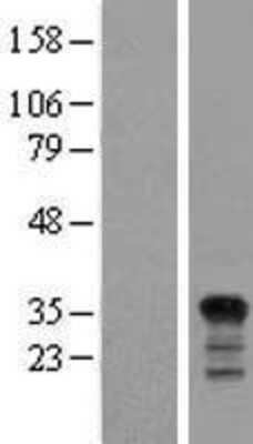 Western Blot: PIG3 Overexpression Lysate [NBL1-17206]