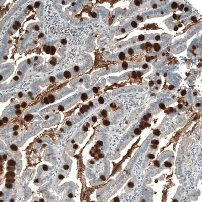 Immunohistochemistry-Paraffin: PIGA Antibody [NBP2-13760]