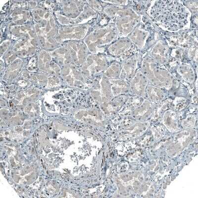 Immunohistochemistry-Paraffin: PIGA Antibody [NBP2-13760]